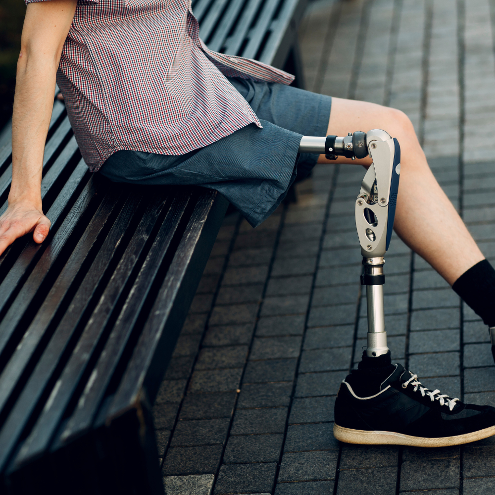 Mann mit Beinprothese sitzt entspannt auf einer Bank.