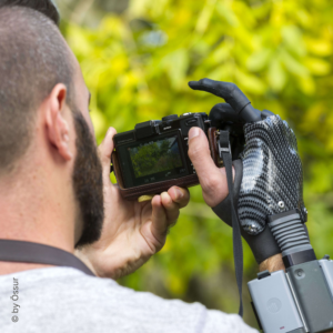 Person mit Handprothese nutzt eine Kamera – verdeutlicht die Feinmotorik und Alltagsfähigkeit der Prothese für komplexe Tätigkeiten.
