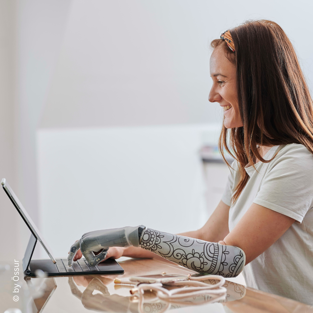 Frau mit stilvoller Handprothese arbeitet an einem Laptop – zeigt die Kombination aus Funktionalität und ästhetischem Design.