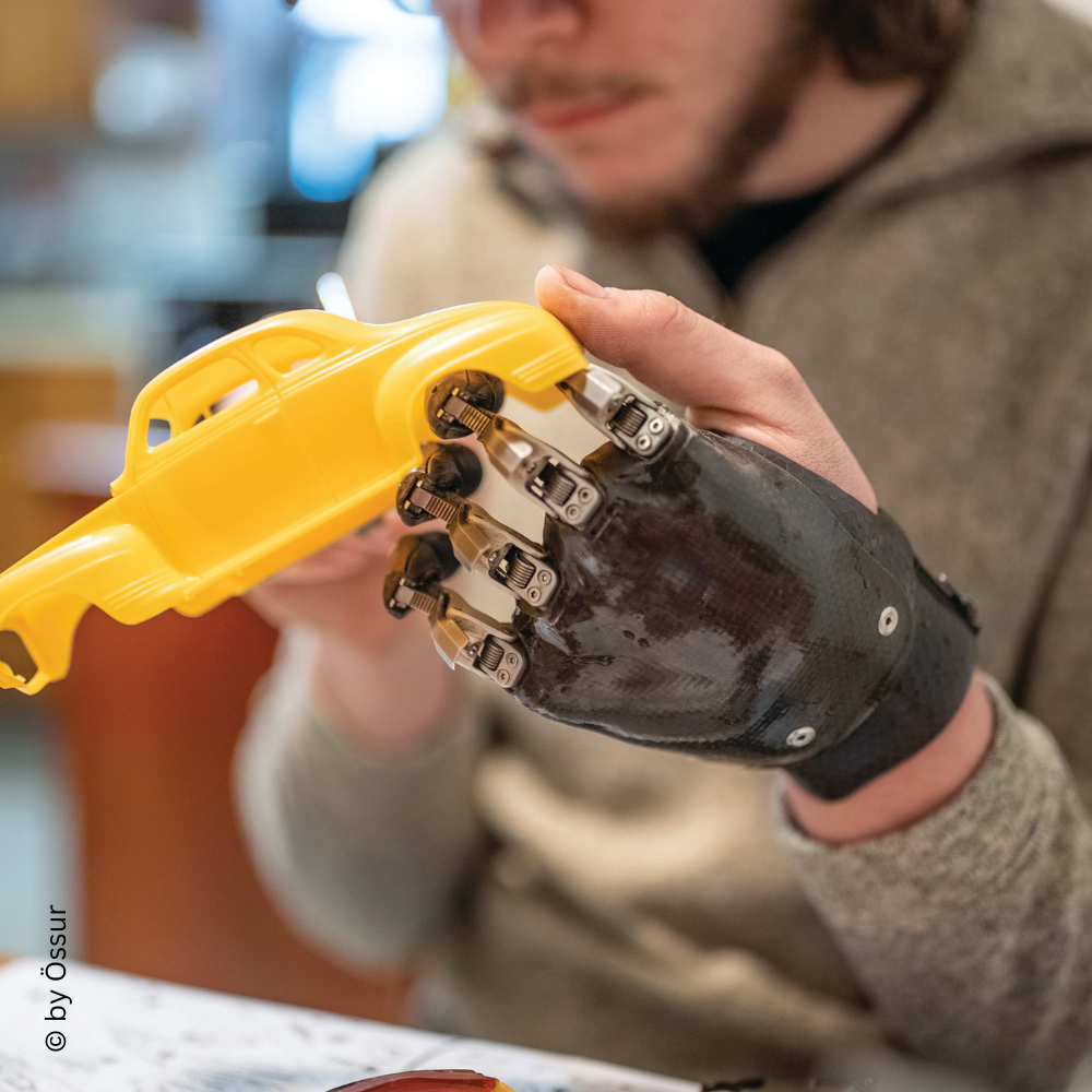 Eine Person hält ein gelbes Spielzeugauto in der Hand, die von einer schwarzen Prothese unterstützt wird. Die Prothese bietet eine präzise Kontrolle für die Handbewegungen.